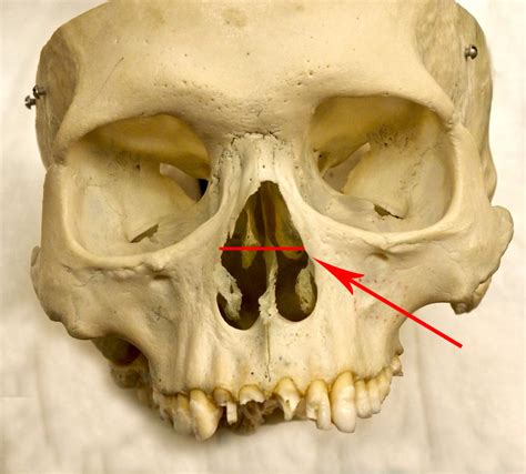 Anterior View Of Nasal 1 Diagram Quizlet