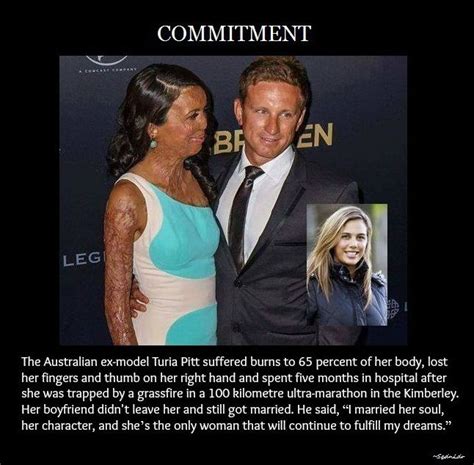 The Australian Ex Model Turia Pitt Suffered Burns To Percent Of Her