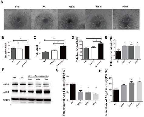 Hematoma Derived Exosomes Of Chronic Subdural Hematoma Promote Abnormal