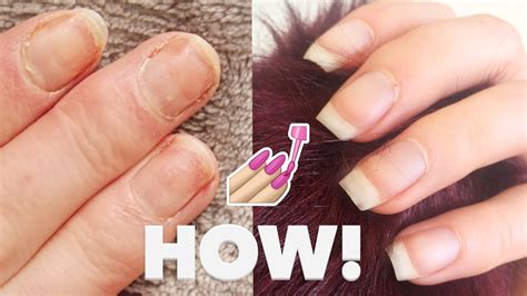 How To Fix Nails Damaged By Acrylics Nail Ftempo