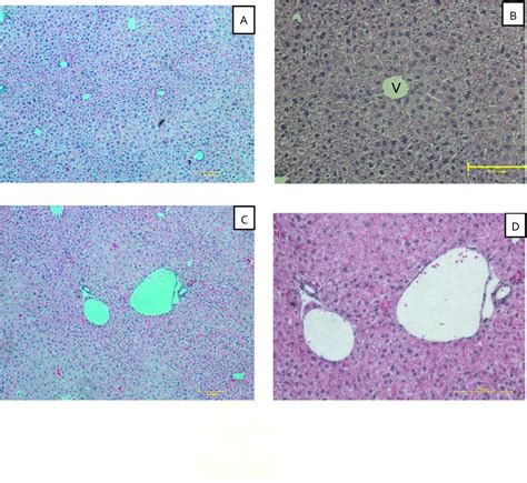 Figure From Effects Of Cytokine Induced Killer Cells On Concanavalin