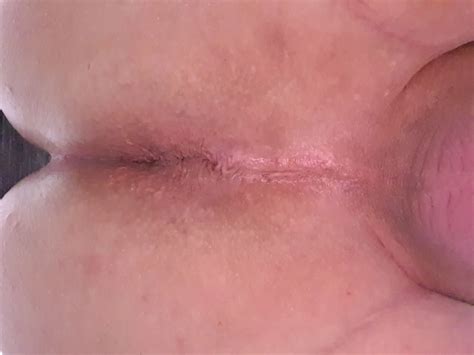 Chiara Is Fat Bitch 33 Nude Pics XHamster