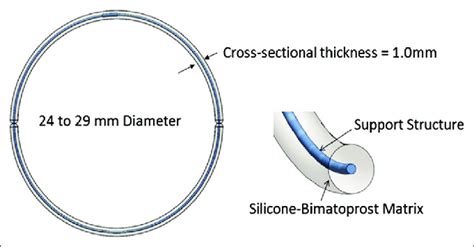 Bimatoprost Ocular Insert Schematic Representation An Inner