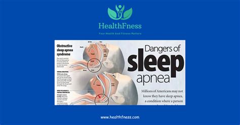 Guide to Bongo Sleep Apnea: Symptoms, Solutions, and Reviews 2024 ...