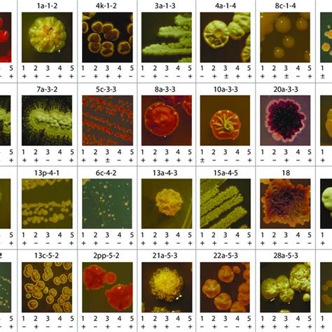 Morphology Of Colonies And Enzymatic Activity Of Isolated Strains