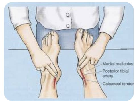 PERIPHERAL VASCULAR ASSESSMENT Flashcards | Quizlet