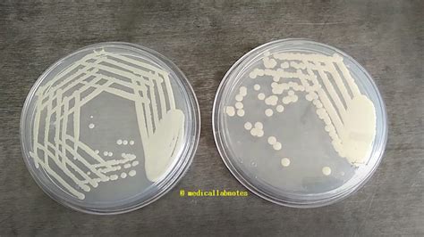 Sabouraud Dextrose Agar Sda Introduction Principle Composit