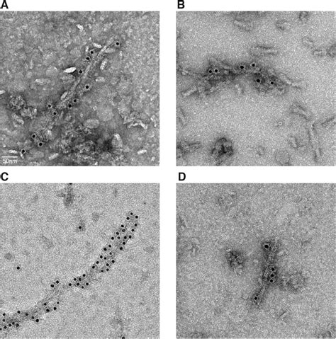 Cryo EM Structures of Amyloid β 42 Filaments from Human Brain bioRxiv