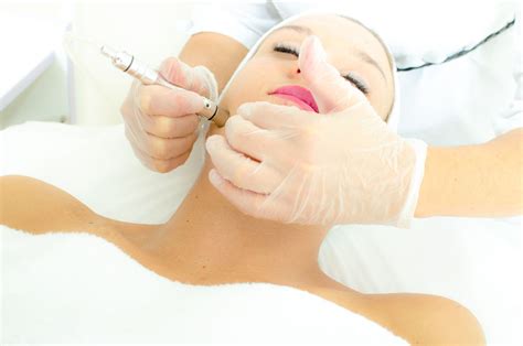 Microdermabrasion Facial Process And Benefits