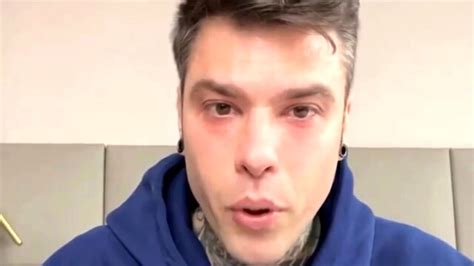 Fedez è stato operato al San Raffaele