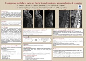 Syndrome M Dullaire