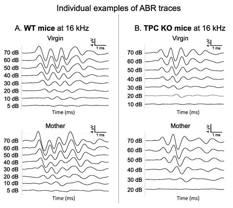 Biomedicines Free Full Text Unexpected Motherhood Triggered Hearing