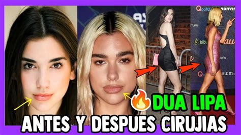 Dua Lipa Antes Y Despues De Cirujias Dua Lipa Luce Muy Diferente