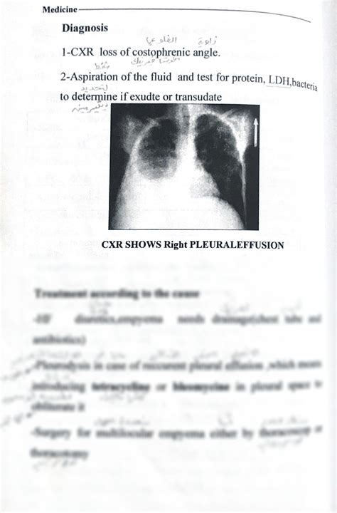 Solution Internal Medicine Respiratory System Notes On Pleural