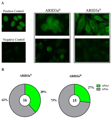 Antibodies | Special Issue : Auto-Antibody and Autoimmune Disease