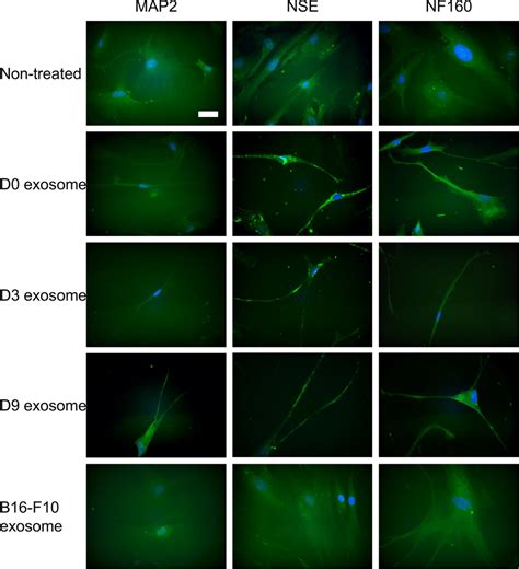 Cell Morphology Of Hmsc After Treatment With Exosomes From Neuronal