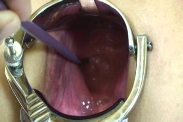 Elmers Wife Anal Speculum ThisVid