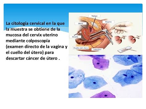 Citologia Citologia Definicin La Citologa Es Una Tcnica