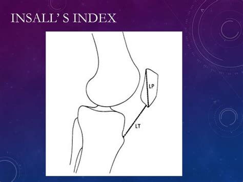 Recurrent Dislocation Of Patella Pawan