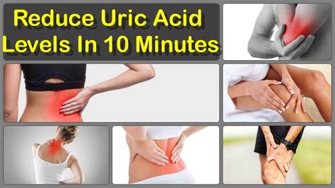 Natural Ways To Lower Uric Acid Levels