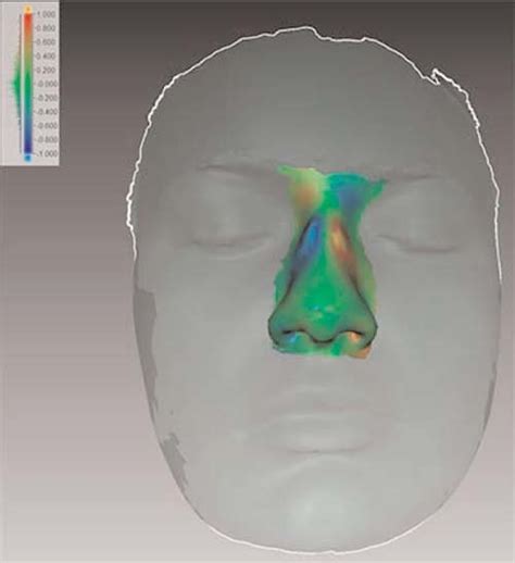 Image showing the deviation color maps after superimposition of... | Download Scientific Diagram