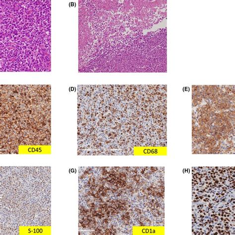 Histopathological Findings Hematoxylin‐eosin Stain Of The Download Scientific Diagram