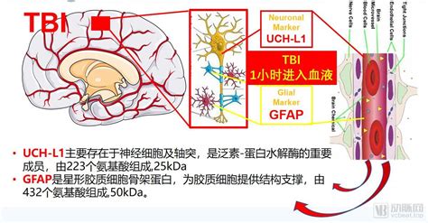 国内首个创伤性脑损伤血清学检测试剂盒获批，tbi诊断进入新时代