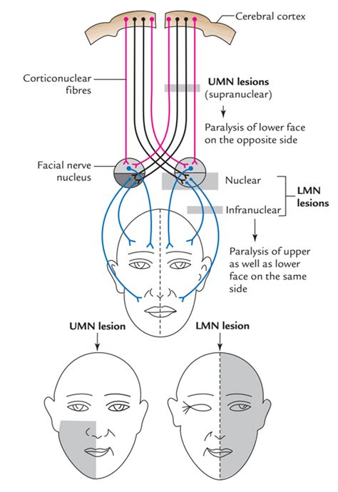 Muscle Facial Nerve Anatomy