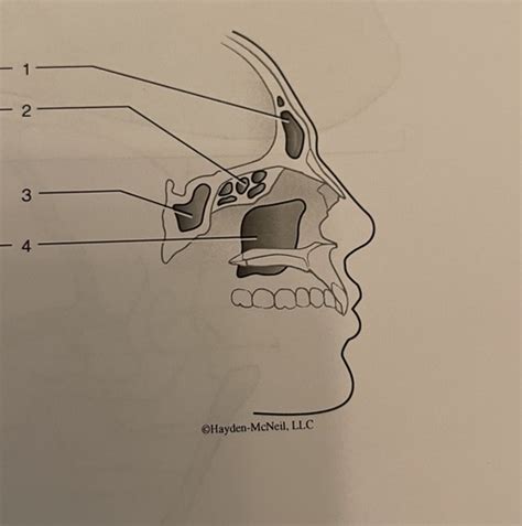 Lab 3 Sinuses And Mandible Flashcards Quizlet