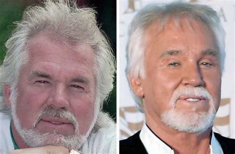 Kenny Rogers Transformation After Plastic Surgery Verge Campus