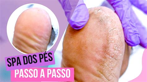 SPA dos Pés Tratamento Podal Passo a Passo YouTube