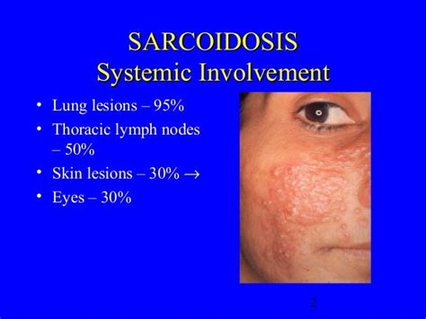 Sarcoidosis Skin Lesions