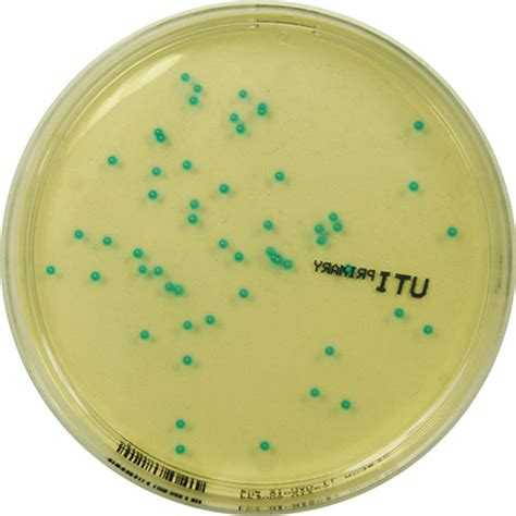 Primary Uti Chromogenic Agar E And O Laboratories Ltd