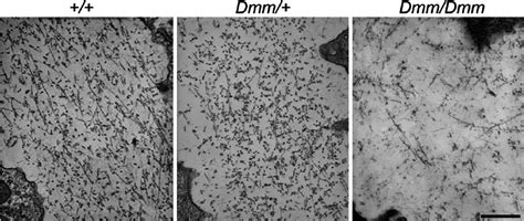 Transmission Electron Micrographs Of The ECM Of Murine Fetal Rib