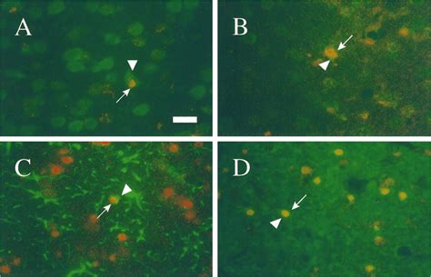 Representative Photomicrographs Illustrating Tunel Labeled Neurons A