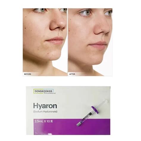 Skin Care Anti Wrinkle Hyaluronic Acid Skin Booster Hyaron 2 5ml 10