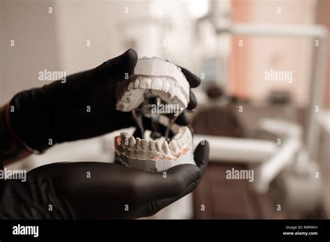 Plaster Cast Of Jaws Dentist In Black Gloves Holding Dental Casting