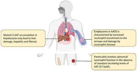 Ijms Free Full Text A Review Of Alpha 1 Antitrypsin Binding Partners For Immune Regulation