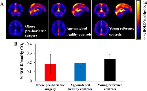 Cerebral Vascular Reactivity Cvr Measured With Whole Brain