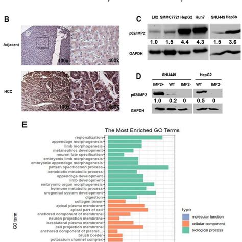 P62imp2 Is Overexpressed In Hcc Tissues And Cell Lines A Mrna