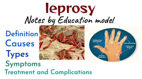 Leprosy Notes Intro Causes Types Symptoms Treatment