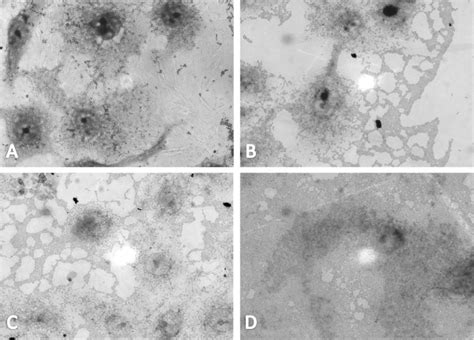 Adhesion Of DAEC And C Freundii To HeLa Cells Adherence To HeLa Cell