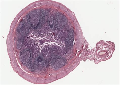 Lymphoid Organs – Meyers Histology