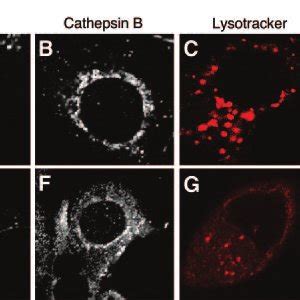 The Effects Of Tnf On The Lysosome And Cathepsin B Lysosomes And