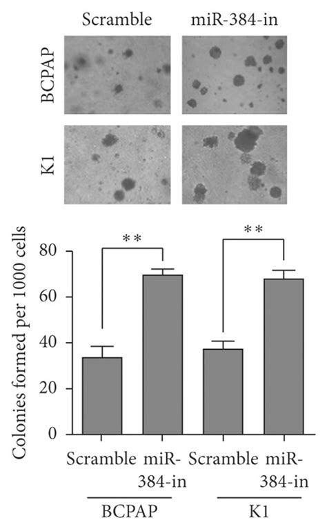 Inhibition Of Endogenous Mir 384 Promoted The Progression Of Ptc Cells