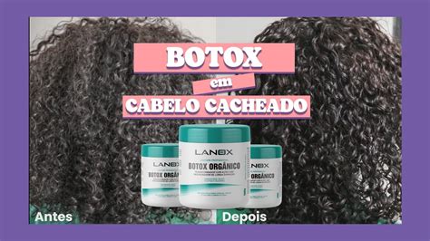 Botox Orgânico O Que é Vantagens E Desvantagens Tudo