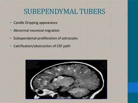 NEUROCUTANEOUS SYNDROME