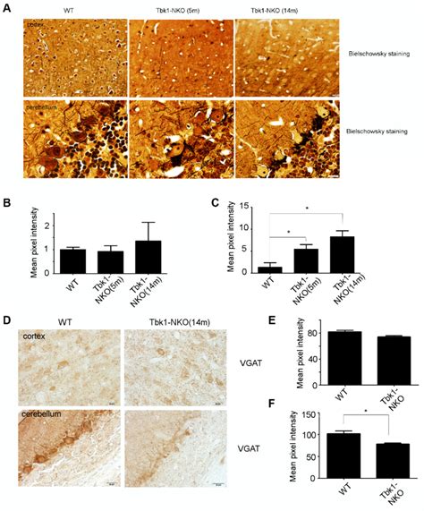 Assessment Of Neuropathological Changes A Bielschowsky Staining Of