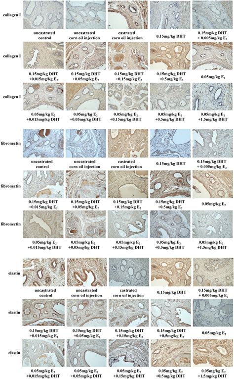 The Expression Of Collagen I Fibronectin And Elastin In Rat Prostates