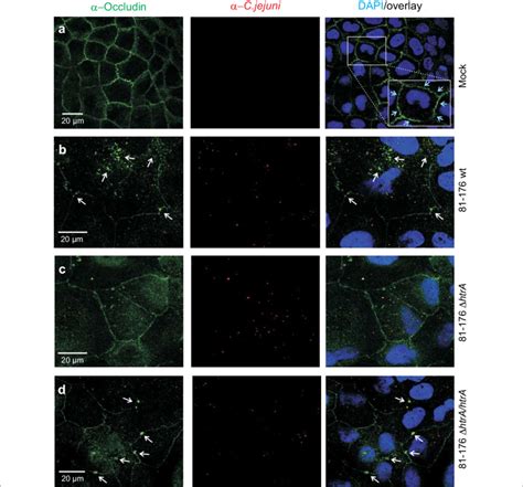 Infection Of Caco Cells With C Jejuni Disturbs The Occludin Patterns